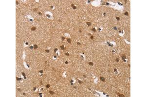 Immunohistochemistry (IHC) image for anti-Calcium Channel, Voltage-Dependent, L Type, alpha 1D Subunit (CACNA1D) antibody (ABIN2432746) (CACNA1D antibody)