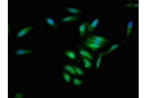 Immunofluorescent analysis of Hela cells using ABIN7157016 at dilution of 1:100 and Alexa Fluor 488-congugated AffiniPure Goat Anti-Rabbit IgG(H+L) (Involucrin antibody  (AA 24-118))