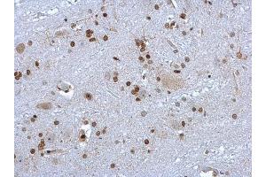 IHC-P Image HMGB1 antibody detects HMGB1 protein at nucleus on rat brain stem by immunohistochemical analysis. (HMGB1 antibody)