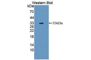 Western blot analysis of the recombinant protein. (TAT antibody  (AA 221-454))