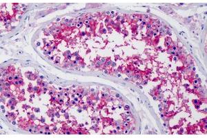 Human Testis: Formalin-Fixed, Paraffin-Embedded (FFPE) (CD147 antibody  (N-Term))