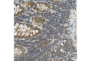 IHC analysis of Bid using anti-Bid antibody (ABIN7599062). (BID antibody  (AA 1-195))