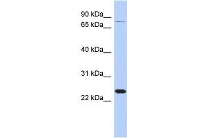 WB Suggested Anti-RPS7 Antibody Titration: 0. (RPS7 antibody  (Middle Region))