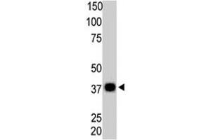 The PPP6C polyclonal antibody  is used in Western blot to detect PPP6C in Thymus tissue lysate. (PPP6C antibody  (N-Term))