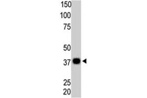 PPP6C Antikörper  (N-Term)