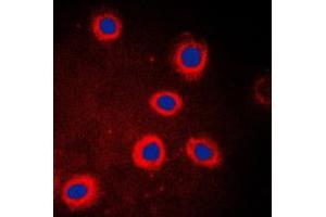 Immunofluorescent analysis of Adenylate Cyclase 9 staining in HeLa cells. (ADCY9 antibody  (N-Term))