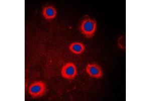 Immunofluorescent analysis of Adenylate Cyclase 9 staining in HeLa cells. (ADCY9 antibody  (N-Term))