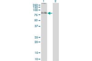 Western Blot analysis of SYVN1 expression in transfected 293T cell line by SYVN1 monoclonal antibody (M01A), clone 4H4. (SYVN1 antibody  (AA 238-318))