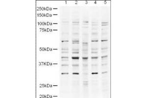 Western blot using  Affinity Purified anti-UBP43 antibody shows detection of a band ~43 kDa band (arrowhead) believed to be to UBP43 in lysates from HeLa nuclear extracts (lane 1) and whole cell lysates from HeLa (lane 2), A431 (lane 3, Jurkat (Lane 4) and HEK293 (lane 5). (USP18 antibody  (AA 40-49))