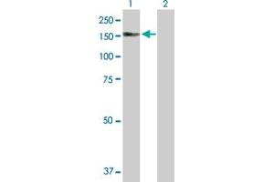 Western Blot analysis of AKAP13 expression in transfected 293T cell line by AKAP13 MaxPab polyclonal antibody.