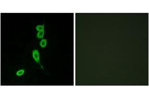 Immunofluorescence analysis of LOVO cells, using MSHR Antibody. (MC1 Receptor antibody  (AA 268-317))