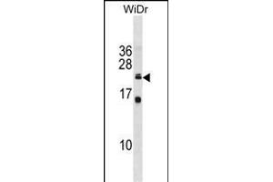 ISCU Antibody (C-term) (ABIN1881467 and ABIN2839004) western blot analysis in WiDr cell line lysates (35 μg/lane).