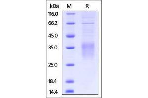 SDS-PAGE (SDS) image for CD28 (CD28) (AA 20-149) protein (His tag) (ABIN2870719)