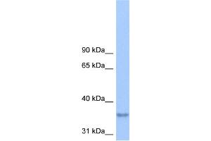 WB Suggested Anti-LPPR2 Antibody Titration:  0.