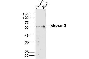 Lane 1: HepG2 lysates Lane 2: 293T lysates probed with glypican 3 Polyclonal Antibody, Unconjugated  at 1:300 dilution and 4˚C overnight incubation. (Glypican 3 antibody  (AA 201-300))