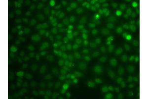 Immunofluorescence analysis of A549 cells using CBLC antibody.