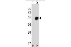 Western blot analysis of NR0B1 (arrow) using rabbit polyclonal NR0B1 Antibody (Center) (ABIN657696 and ABIN2846687). (NR0B1 antibody  (AA 304-333))