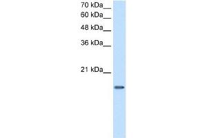 DUT antibody used at 2. (Deoxyuridine Triphosphatase (DUT) (C-Term) antibody)