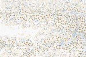 Immunohistochemistry (Paraffin-embedded Sections) (IHC (p)) image for anti-RNA Polymerase II Associated Protein 2 (RPAP2) antibody (ABIN7075481)