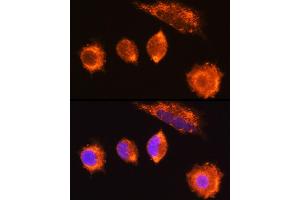 Immunofluorescence analysis of L929 cells using MG Rabbit pAb (ABIN6132348, ABIN6143808, ABIN6143810 and ABIN6222011) at dilution of 1:100 (40x lens). (MGAT1 antibody  (AA 156-445))