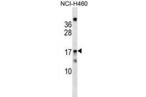Western Blotting (WB) image for anti-Mitochondrial Ribosomal Protein S11 (MRPS11) antibody (ABIN2999548) (MRPS11 antibody)