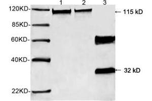 Western blot analysis of recombinant human Calcineurin A protein and mouse brain tissue lysate using 0. (Calcineurin A antibody  (N-Term))