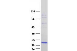 Validation with Western Blot (FXYD6 Protein (Transcript Variant 3) (Myc-DYKDDDDK Tag))