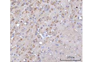 IHC analysis of RARS/RARS1 using anti-RARS/RARS1 antibody (ABIN7600223). (Probable Arginine--tRNA Ligase, Cytoplasmic (RARS-1) (AA 165-425) antibody)