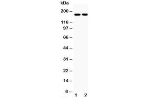 Western blot testing of Topoisomerase II alpha antibody and Lane 1:  HeLa;  2: Jurkat;  Predicted size: 174KD;  Observed size: 174KD (Topoisomerase II alpha antibody  (C-Term))