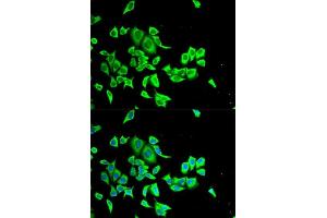 Immunofluorescence analysis of HeLa cells using SERPINB1 antibody. (SERPINB1 antibody  (AA 100-379))