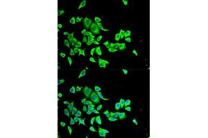 Immunofluorescence analysis of HeLa cells using SERPINB1 antibody. (SERPINB1 antibody  (AA 100-379))