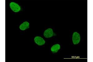 Immunofluorescence of purified MaxPab antibody to DDX5 on HeLa cell. (DDX5 antibody  (AA 1-614))