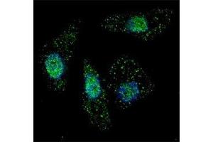 Fluorescent image of Chloroquine treated U251 cells stained with ATG7 antibody at 1:200. (ATG7 antibody  (AA 494-523))