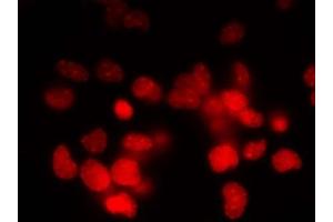 Immunofluorescence (IF) image for anti-Small Ubiquitin Related Modifier 2/3 (SUMO2/3) (full length) antibody (ABIN2452139)