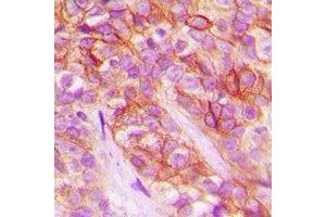 Immunohistochemistry (IHC) image for anti-Angiotensin II Receptor, Type 1a (AGTR1a) antibody (ABIN7303410)