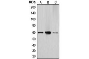 Western blot analysis of Cytochrome P450 27A1 expression in HepG2 (A), Caco2 (B), A549 (C) whole cell lysates. (CYP27A1 antibody  (Center))