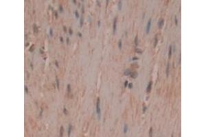 Figure. (MYH4 antibody  (AA 1633-1875))