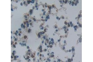 Used in DAB staining on fromalin fixed paraffin- embedded Kidney tissue (ITGA2 antibody  (AA 212-370))