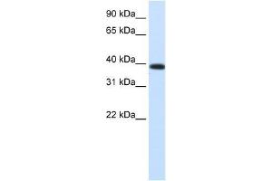 PTDSR antibody used at 0. (JMJD6 antibody  (Middle Region))