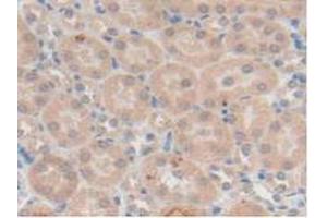 IHC-P analysis of Mouse Kidney Tissue, with DAB staining. (TFF1 antibody  (AA 1-87))