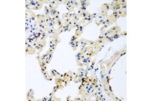 Immunohistochemistry of paraffin-embedded rat lung using LEPREL2 antibody at dilution of 1:200 (40x lens).