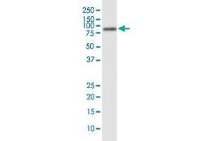 AFP (Human) IP-WB Antibody Pair