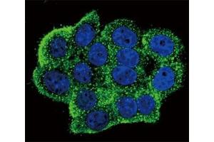 Confocal immunofluorescent analysis of phospho-TERT antibody with HeLa cells followed by Alexa Fluor 488-conjugated goat anti-rabbit lgG (green). (TERT antibody  (pTyr707))