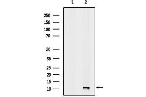 Western blot analysis of lysates from Pc12, using CSTB Antibody.