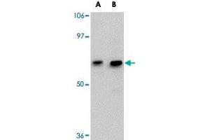 Western blot analysis of GALNT10 in SK-N-SH cell lysate with GALNT10 polyclonal antibody  at (A) 1 and (B) 2 ug/mL . (GALNT10 antibody  (C-Term))