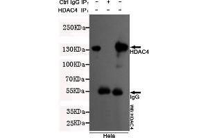 Immunoprecipitation analysis of Hela cell lysates using HDAC4 mouse mAb. (HDAC4 antibody  (N-Term))