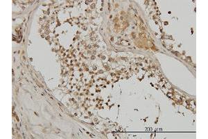 Immunohistochemistry (Formalin-fixed Paraffin-embedded Sections) (IHC (fp)) image for anti-Actinin, alpha 4 (ACTN4) (AA 592-701) antibody (ABIN559759)