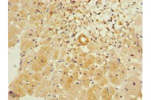 Immunohistochemistry of paraffin-embedded human heart tissue using ABIN7156429 at dilution of 1:100 (ITGA11 antibody  (AA 940-1141))