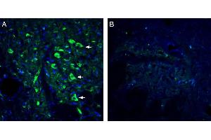 Expression of 5HT2A Receptor in rat dorsal raphe nucleus. (HTR2A antibody  (Extracellular))