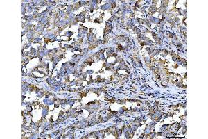 IHC analysis of CD147/Emmprin using anti-CD147/Emmprin antibody (ABIN7599999). (CD147 antibody  (AA 138-323))